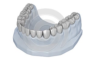 Wax-up teeth model. Treatment Planning. Medically accurate tooth 3D illustration