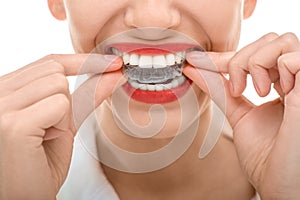 Wearing orthodontic silicone trainer