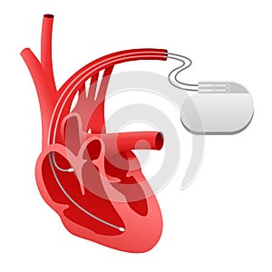 Pacemaker cardio stimulator icon photo