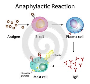 Anaphylactic reaction and allergic reaction mechanism. photo