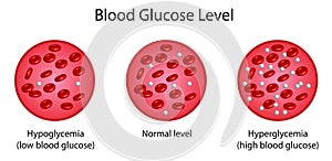 Blood Glucose Levels. normal level, hyperglycemia , hypoglycemia, sugar test. vector diagram photo