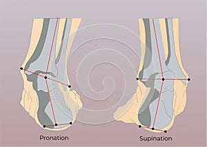 Foot supination and pronation vector illustration. photo
