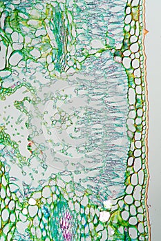 Weed leaf cross section under the microscope