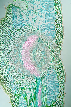 Weed leaf cross section under the microscope