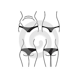 Weight loss concept back and front view - black underwear - isolated on white background