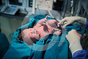 Welcome to the world sweet angel. a newly born baby girl surrounded by medical staff in the hospital.