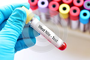 West Nile test