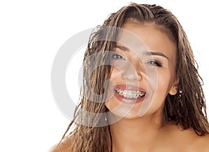 Wet hair and braces