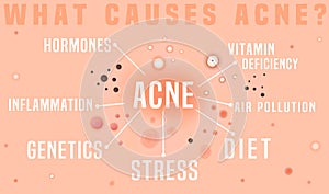 What causes acne poster. Skin disease, dermatology, cosmetology concept.