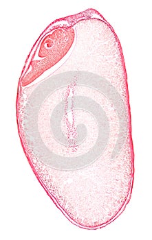 Wheat grain, cross section of a whole wheat berry, 8X light micrograph