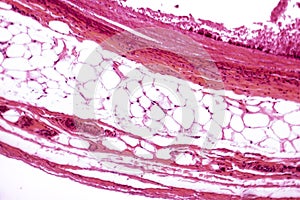 White adipose tissue