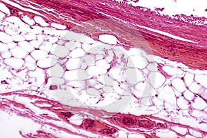 White adipose tissue photo