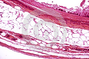 White adipose tissue photo