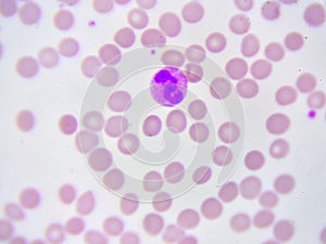 White blood cell