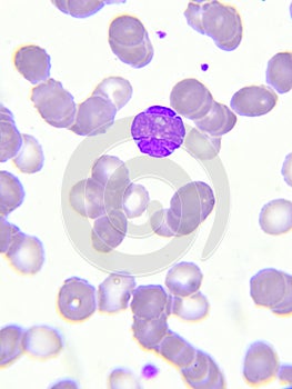 White blood cell