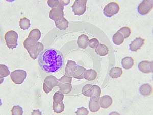 White blood cell