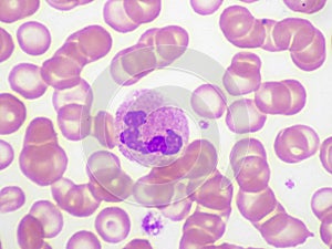 White blood cell in blood smear