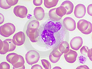 White blood cell in blood smear