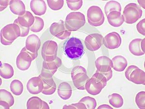 White blood cell in blood smear