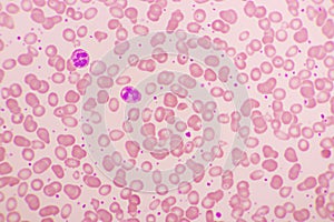 White blood cell in blood smear