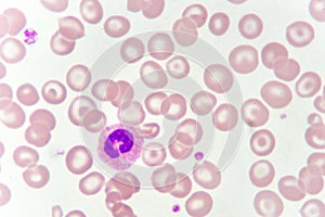 White blood cell in blood smear