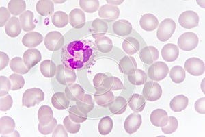 White blood cell in blood smear