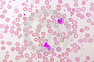 White blood cell in blood smear