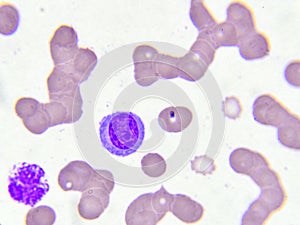 White blood cells