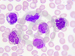 White blood cells in blood smear