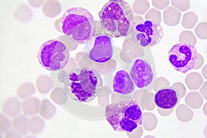 White blood cells in blood smear