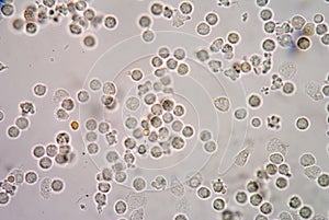 White blood cells of a human, photomicrograph panorama as seen u photo