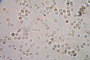 White blood cells of a human, photomicrograph panorama as seen u photo