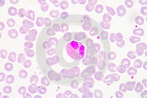 White blood cells of a human, photomicrograph panorama as seen u photo