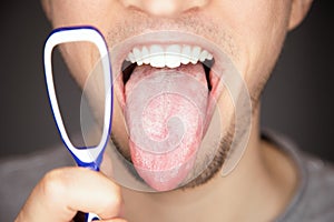 white covered and coated tongue out with tiny bumps is indicator for sickness and infections and reason for bad breath