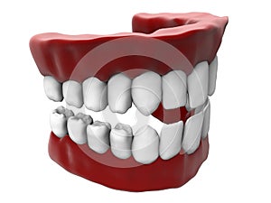 White denture illustration