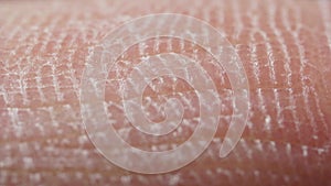 White detailed caucasian human skin closeup in macro