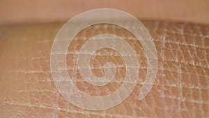 White detailed caucasian human skin on hand fingers closeup in macro