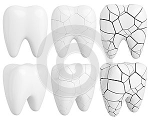 White glossy and fractured teeth set. Dentistry design elements. 3D rendered image.
