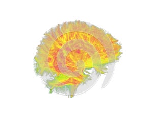 White Matter Tractography of the Human Brain photo