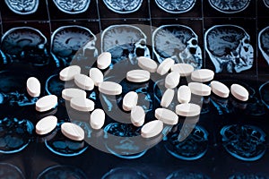 White pharmaceutical medicine pills on magnetic brain resonance scan mri background. Pharmacy theme, health care