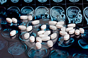 White pharmaceutical medicine pills on magnetic brain resonance scan mri background. Pharmacy theme, health care