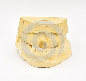 Dental Molds on White Background
