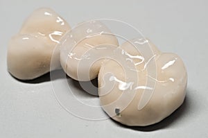 Bianco porcellana dentale corona 
