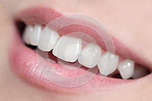 White, shiny and healthy smile