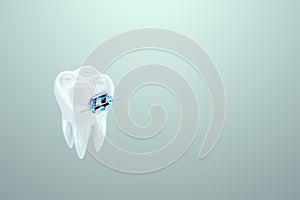 White teeth with metal braces on a blue background. Dental braces, orthodontic treatment, dentistry, teeth whitening, protection,
