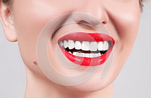 White teeth and red lips. Perfect female smile after whitening teeth.