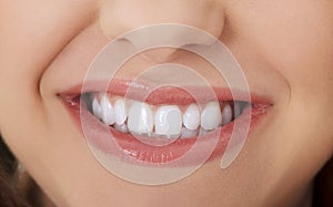 White teeth in smile