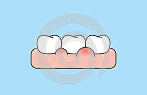 The white teeth with swollen gums disease illustration vector design on blue background. Dental care concept