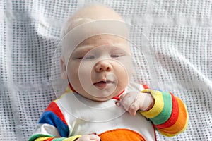 Whitehair babyboy with albinism syndrome