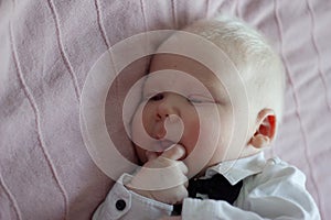 Whitehair babyboy with albinism syndrome